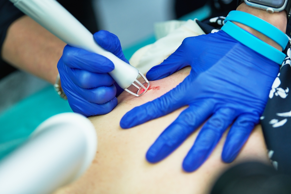 Laser,Cosmetic,Surgery,And,Skin,Resurfacing,In,Dermatology